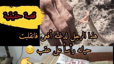 قصة الرجل الذي لدغته افعي